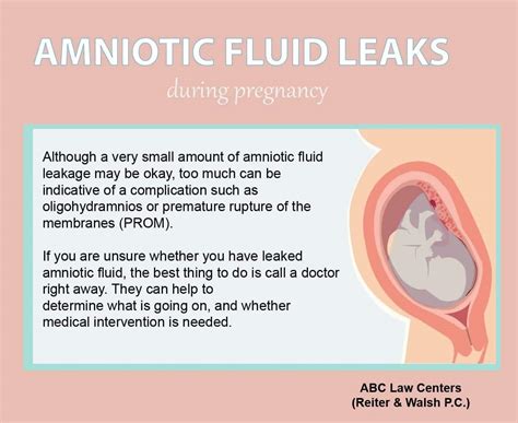 how to tell if leaking amniotic fluid|Leaking amniotic fluid: Signs and what to do